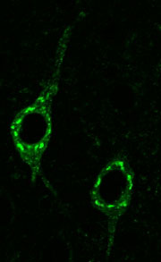 Confocal microscope image of neurons in the 3xTgAD mice stained for the amyloid-� (A�) precursor protein (APP) showing APP (green) within these nerve cells which were not labeled by antibodies that detect free A�, the peptide cleavage product of APP that, when released from APP by proteases will be secreted and for Alzheimer plaques outside nerved cells in the brain of these mice similar to Alzheimer patients.